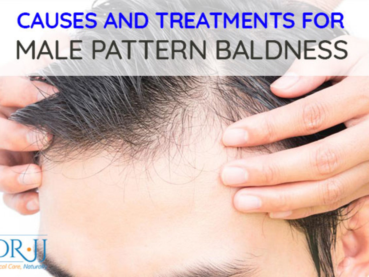 Causes And Treatments For Male Pattern Baldness Dr Jj Naturopathic Doctor Downtown Toronto Naturopath