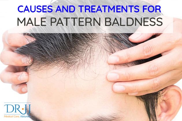Causes And Treatments For Male Pattern Baldness | Dr. JJ | Naturopathic Doctor in Toronto Downtown