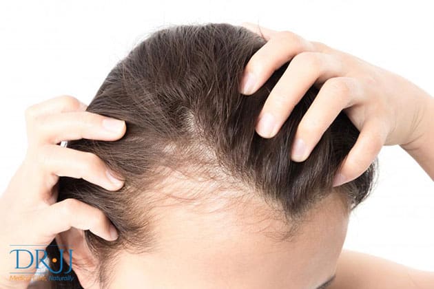 female baldness and how to prevent it | Dr. JJ Dugoua, ND | Naturopathic Doctor in Toronto